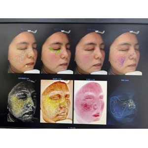 徐州旭美整形医院是正规医院吗？医师团队-热门项目价格更新