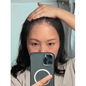 合肥大额角植发医院哪家好？这5家技术实力都很强