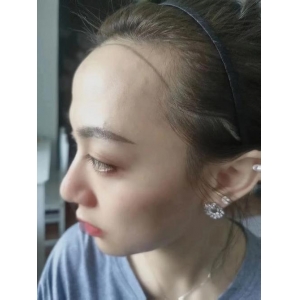 荆州华美植发技术怎么样？价格亲民效果显著