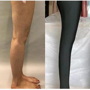 南昌贵美人医疗整形医院怎么样？抽脂瘦身费用，医生技术，整形问答！