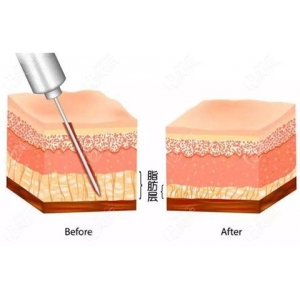 长沙雅美跟爱思特到底哪个好些?对比两家医院资质和医生介绍看谁更好