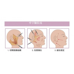 南昌哪些医生做面部拉皮好?正规整形医生实力在线测评