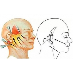 深圳文丰医生小拉皮手术技术怎么样?网友盛赞其技术精湛且价格公道