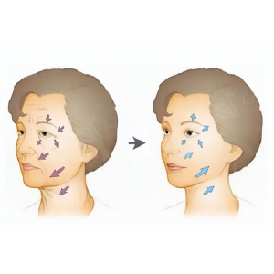 腹部拉皮与腹壁整形有何区别？产后松弛肚皮能否恢复紧致？