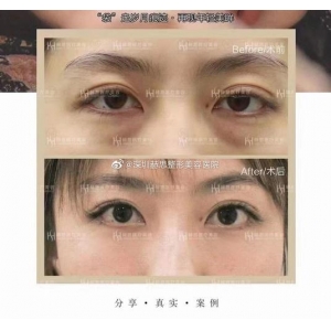 西安画美欧洲之星怎么样？哪些医生擅长？