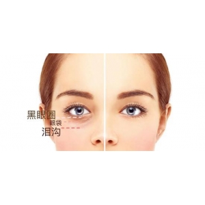 廊坊三河慈康医疗美容自体脂肪祛泪沟专家推荐，高人气医生团队介绍