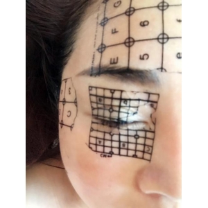 在成都新丽美做的热玛吉怎么样价格多少钱