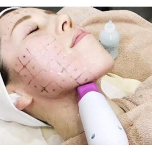 济宁韩美医疗整形美容热玛吉价格贵吗?2025年最新收费及效果解析