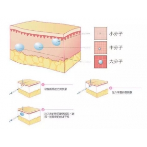 佛山曙光金子医学美容医院玻尿酸丰下巴多少钱？专家团队、真实案例、价格表