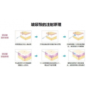 佛山华美联城整形美容医院玻尿酸注射多少钱？医院详情解析，最新价目表公开