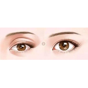 青岛玻尿酸丰下巴专家排名推荐!这些医生技术真的靠谱吗?