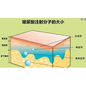 郑州韩辰华领医疗美容医院玻尿酸填充价格是多少？医生团队-技术特色-收费标准全面解析