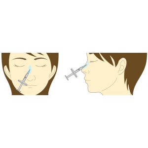 玻尿酸隆鼻副作用介绍~