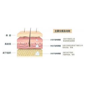 深圳博爱曙光医疗美容医院玻尿酸价格公开，真实案例分享丨专业医师团队坐诊