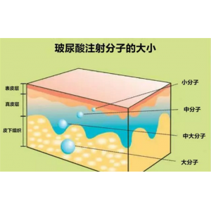 北京注射玻尿酸的费用一般在多少？