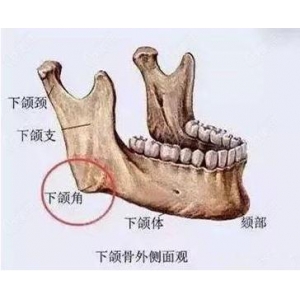 张笑天医生磨骨专业吗？内附出诊时间案例前后对⽐照2025年价格表