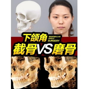 重庆肖林医生口碑佳无差评,主攻颧骨颧弓下颌角手术,偏爱自然化修饰