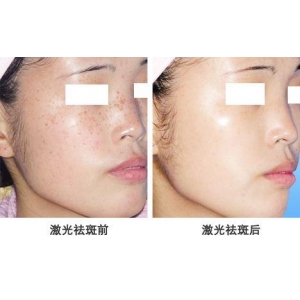 北京祛斑效果好的正规医院，专业医生团队实力解析