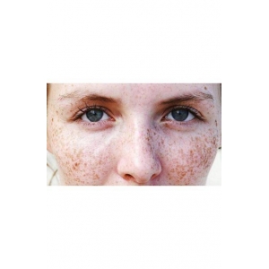 大连祛斑有名的医生排行,任丽霞、林晓曦、于延等实力上榜!