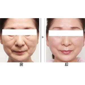 厦门抗衰除皱整形医院哪家好？海峡、欧菲、脸博士等知名机构上榜