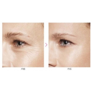 海口抗衰除皱哪家医院好?五家实力机构医生技术价格全解析