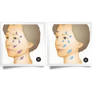 南京做水光除皱的医院医生有哪些，技术技术怎么样