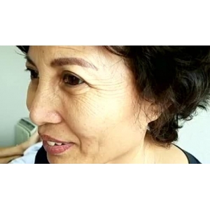 抗衰除皱后这些事千万别做！太原丽都医疗美容医院专家曝光术后注意事项