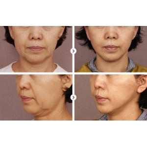 珠海抗衰除皱医院排名榜单,专业医生团队坐诊推荐