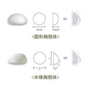 天津自体脂肪隆胸专家排行|本地知名医生信息汇总