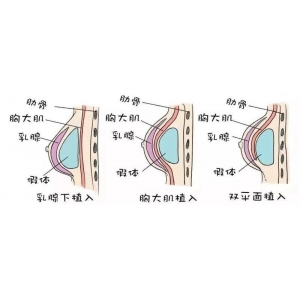 王明利，刘成胜，王绍国，任学会哪个好？内附医生信息分享