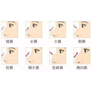 绵阳韩美整形医院隆鼻好吗？隆鼻技术优势+口碑医生介绍！