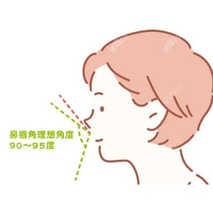 韩臻医疗美容医院隆鼻怎么样？医院实力测评附隆鼻案例