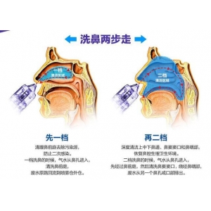 北京沃尔刘彦军医疗美容诊所冯雁平鼻部整形技术怎么样?医生简介-手术效果-费用参考