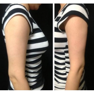 重庆美轮美奂医院整形收费贵吗？隆鼻、双眼皮、吸脂等价格不贵！