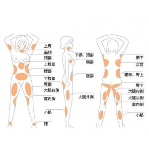 潍坊天宏医疗美容医院去副乳手术哪个医生技术好?王圣雷、张明欣等专家团队解析