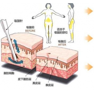 济南韩式医美机构技术怎么样?是否值得信赖?特色项目一览