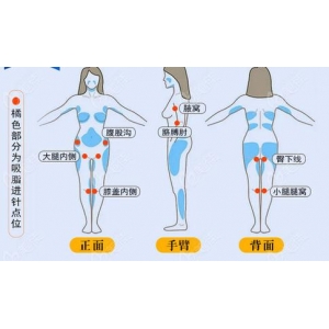 任正义医生做腰腹吸脂手术前后对比？来看真实案例