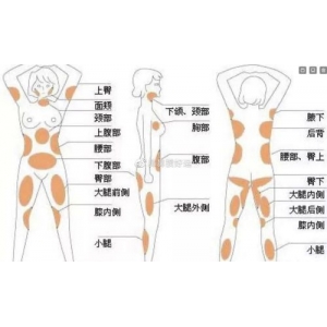 潍坊天宏医疗美容医院手术去副乳多少钱？专家介绍、技术优势、价格明细