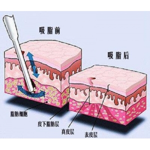 自贡铂美医疗整形医院好不好？擅长项目多，坐诊医生也很有实力！
