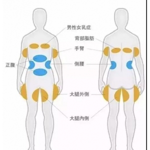 北京吸脂专家候舍予靠谱吗？做腰腹吸脂技术好不好？