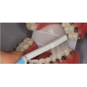 杭州牙齿种植医院哪家好？浙大二院、市一等7家医院实力解析