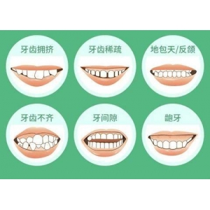 医生汇总-汕头曙光医院整形正规吗？院内颧骨切除真实案例分享