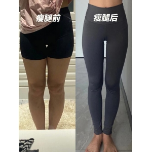 南京中大医院整形科怎么样？内含价格表及案例分析