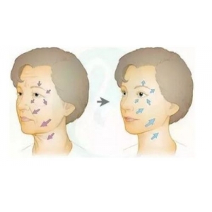 北京八大处刘暾做线雕隆鼻怎么样？想做线雕隆鼻？来看本人真实经历