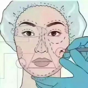 成都线雕隆鼻整形精选医院，口碑技术与性价比全面解析