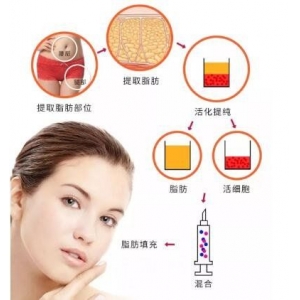 南京自体脂肪填充医院排名前十强康美、美贝尔、华韩奇致实力上榜