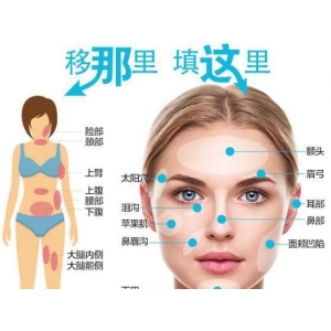 如何确保脂肪填充术后效果？西安艺星黄凯医生的经验分享