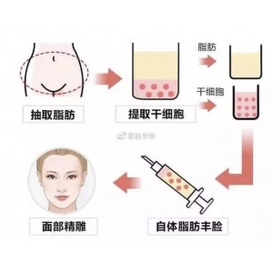 蒋铮铮医生技术怎么样?幼态脸整形案例分享丨馒化修复效果显著收费合理审美在线