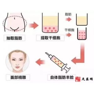 哈尔滨轮廓塑形医院哪家好？伊美尔、艺星、超龙等实力医美推荐！