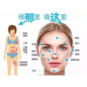 长春自体脂肪填充哪家医院好？5家优质机构深度解析